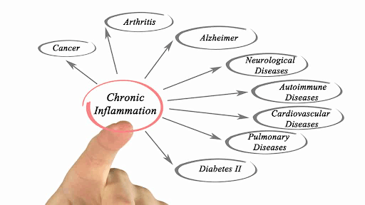 Weightless inflammation chart